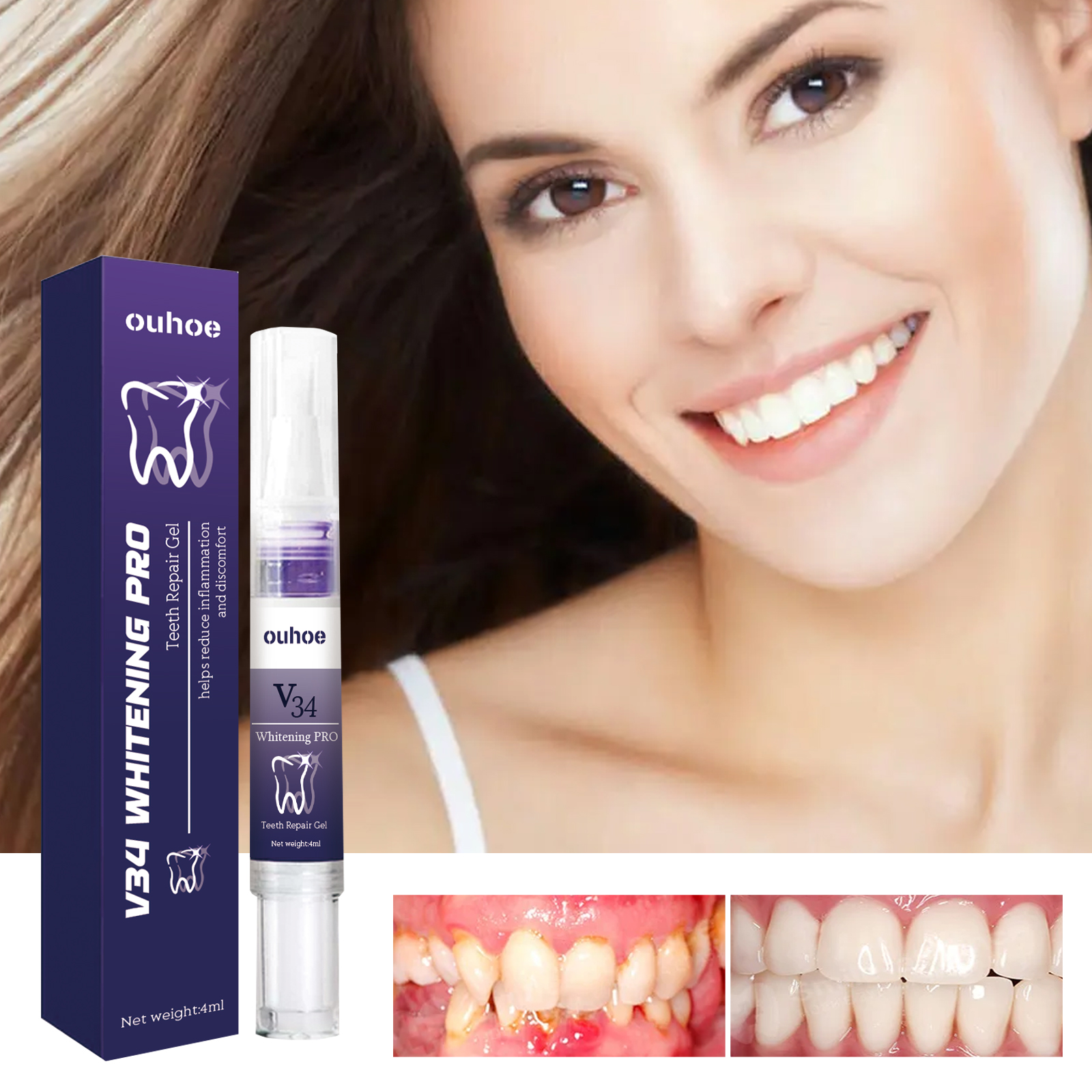 Teeth Whitening Serum - Rapid Repair Damaged Gums Gel Serum