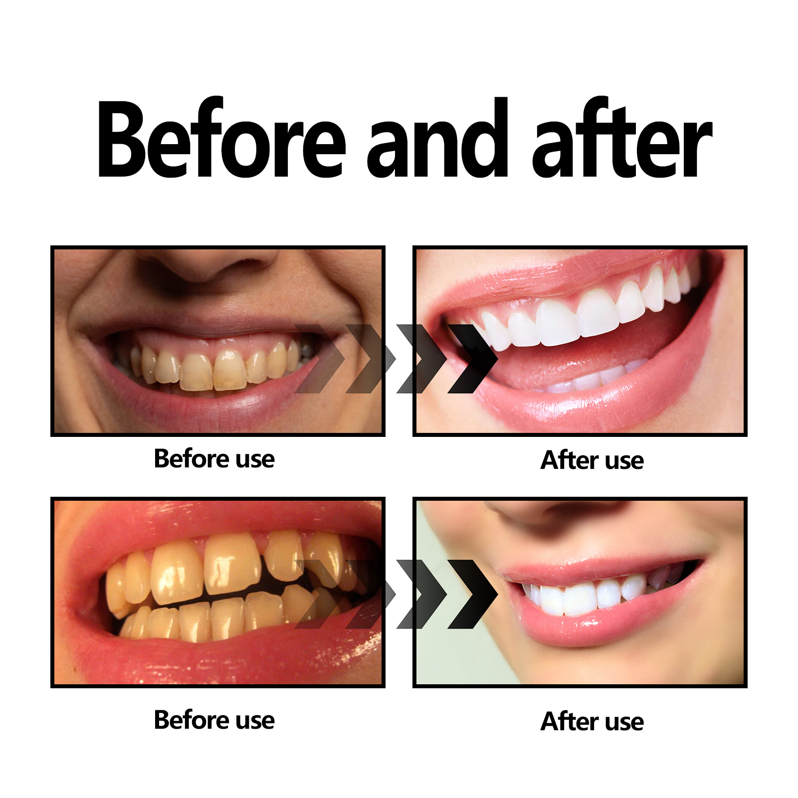 Activated Coconut Charcoal Too - Teeth Whitening With Coconut Oil ulasan dan harga