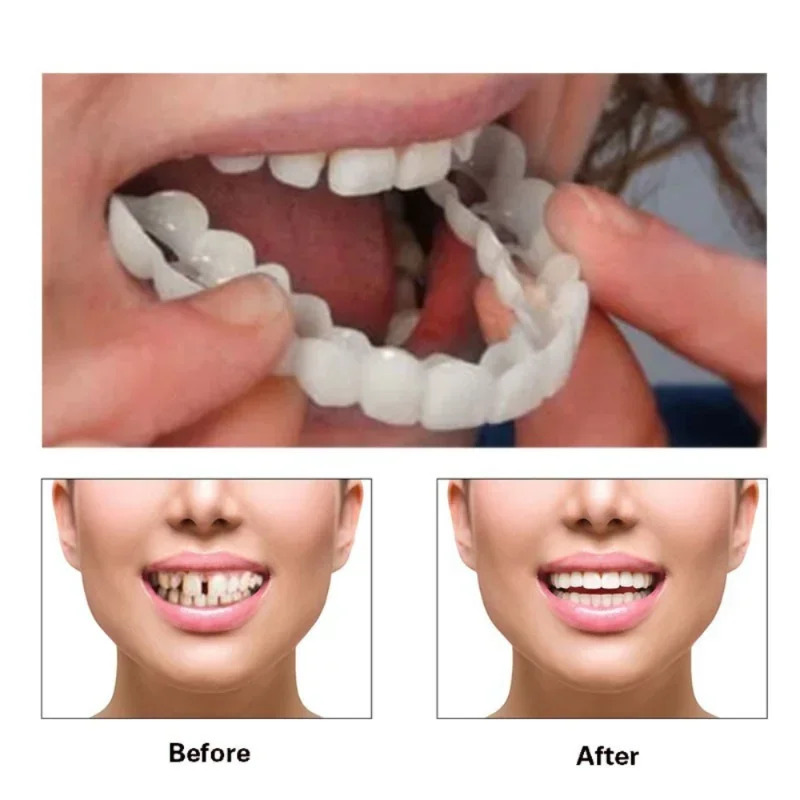 Quick Makeup Teeth Veneers, In - Teeth Whitening Fast ulasan dan harga