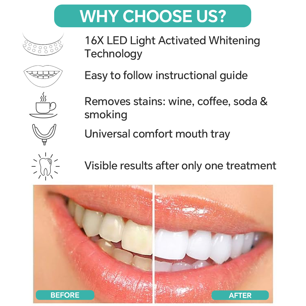 Teeth Whitening Enhancer Light - Led Mouth Tray ulasan dan harga