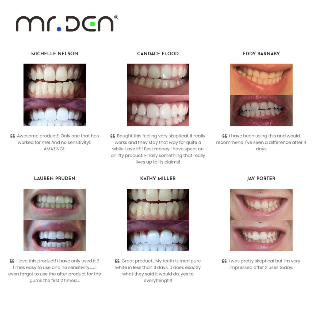 Dr. Whiten 3 Pack Teeth Whiten - Teeth Whitening Kit ulasan dan harga
