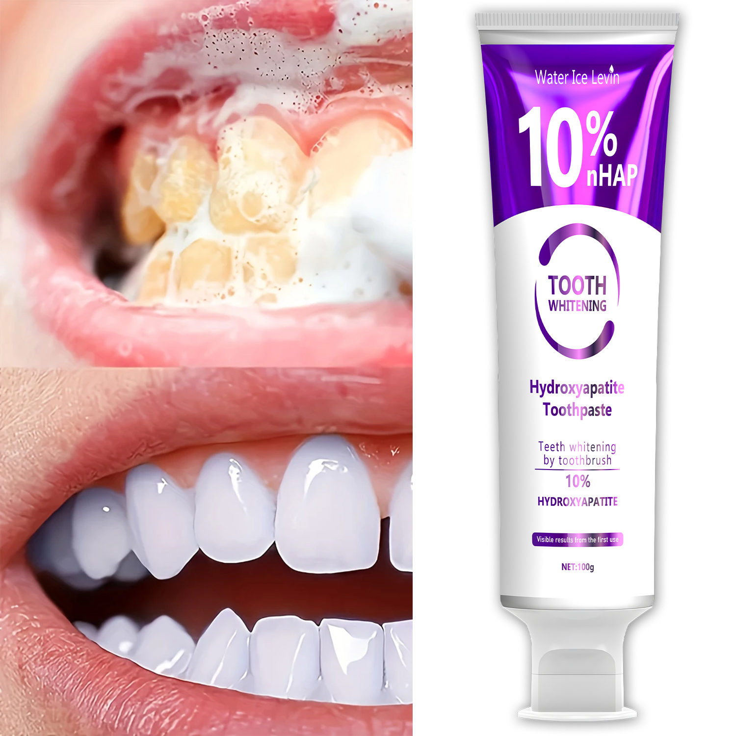 10% Nanoh Hydrogen Oxide Tooth - Remineralizing Toothpaste ulasan dan harga