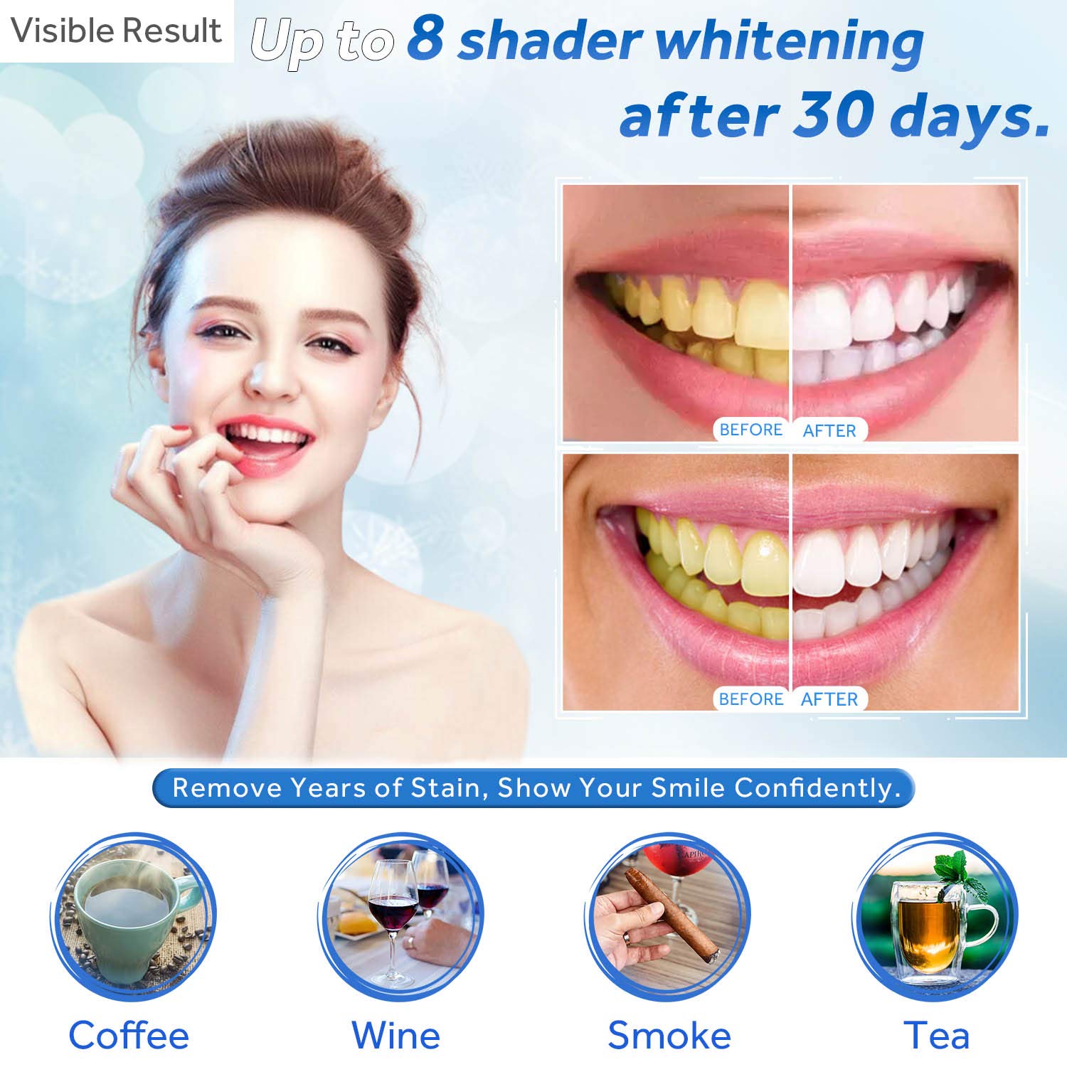 Teeth Whitening Gel Refill Syr - Teeth Whitening Accelerator ulasan dan harga