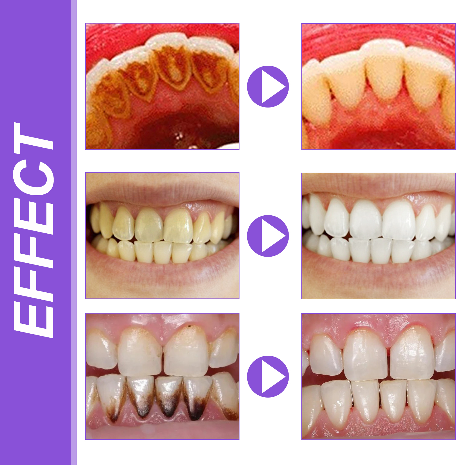 EELHOE Smiles Bright White Ref - Teeth Whitening Serum ulasan dan harga