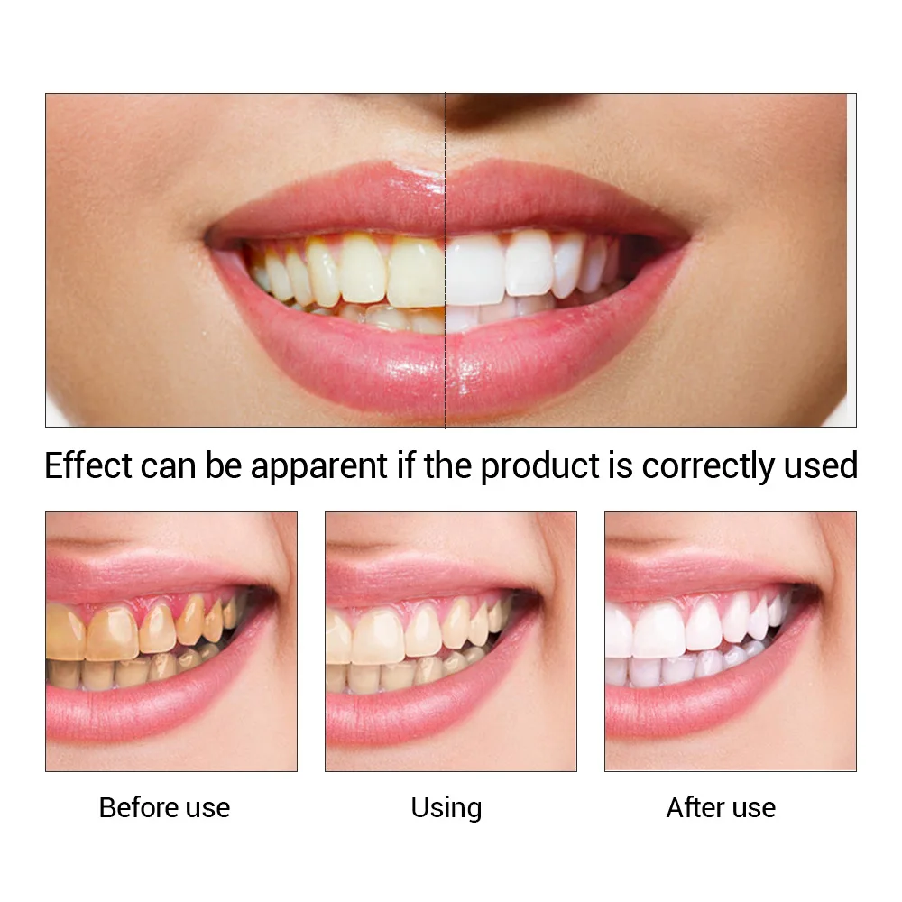 FTEENPLY Teeth Whitening Essen - Teeth Whitening Serum ulasan dan harga