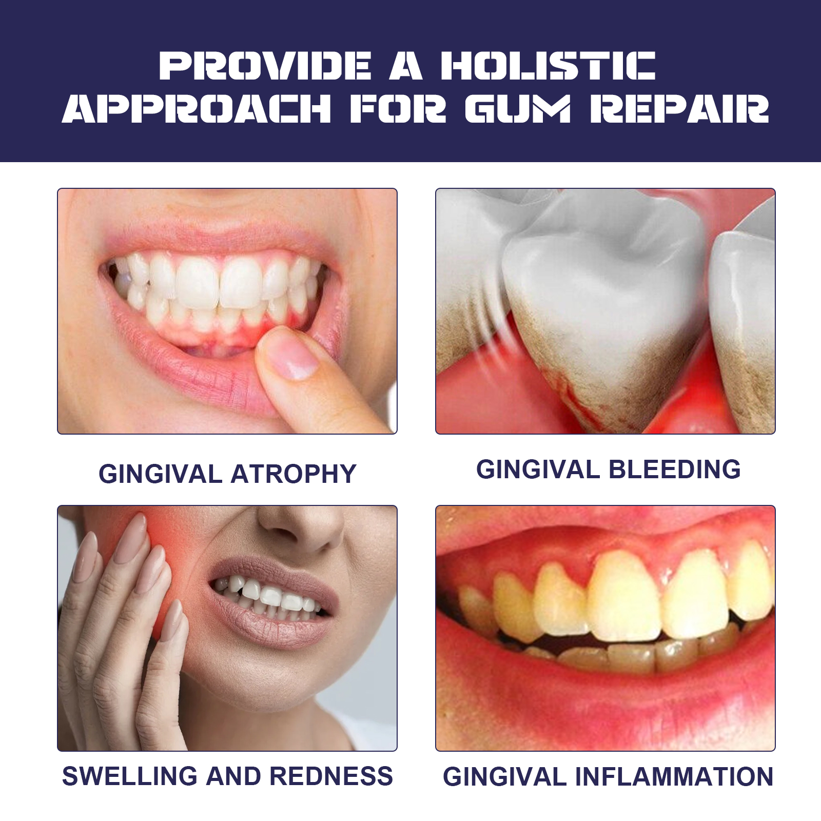Rapid Repair Damaged Gums Gel  - Teeth Whitening Serum ulasan dan harga