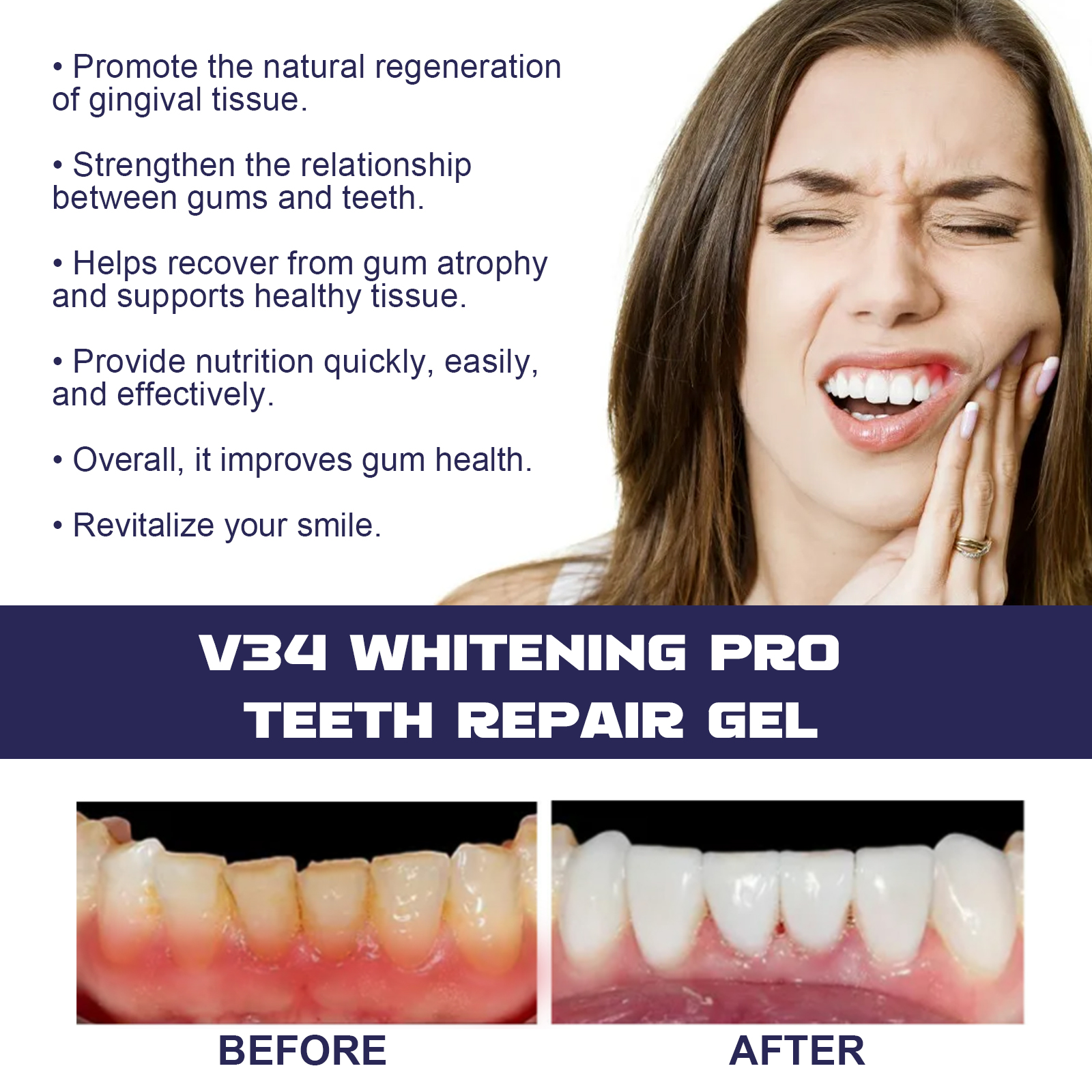 Rapid Repair Damaged Gums Gel  - Teeth Whitening Serum ulasan dan harga