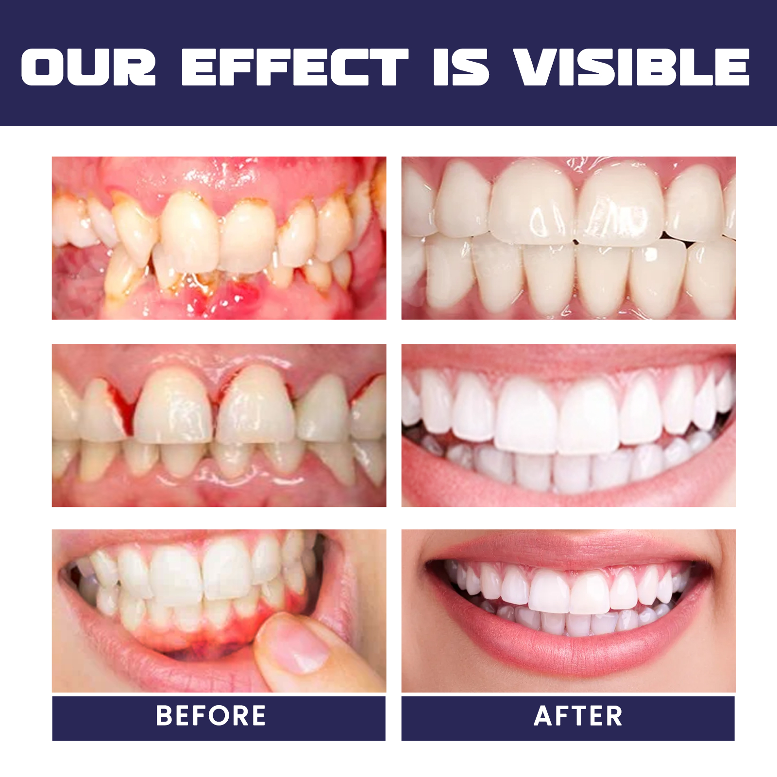 Rapid Repair Damaged Gums Gel  - Teeth Whitening Serum ulasan dan harga