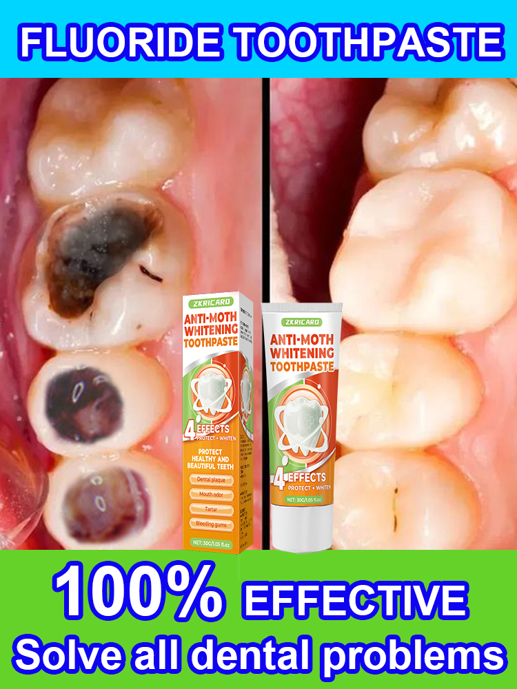 Repair tooth decay and whiten  - Teeth Whitening That Works ulasan dan harga