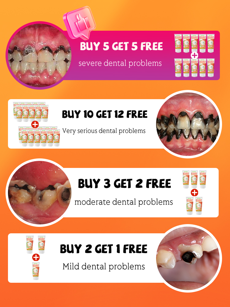 Repair tooth decay and whiten  - Teeth Whitening That Works ulasan dan harga