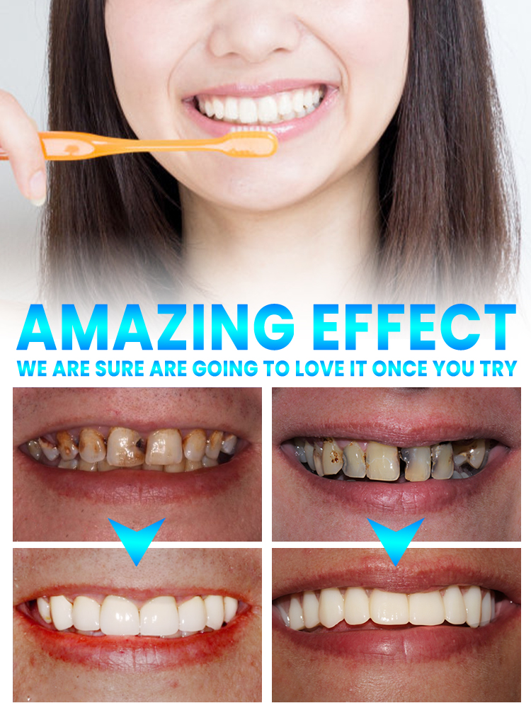 Repair tooth decay and whiten  - Teeth Whitening That Works ulasan dan harga