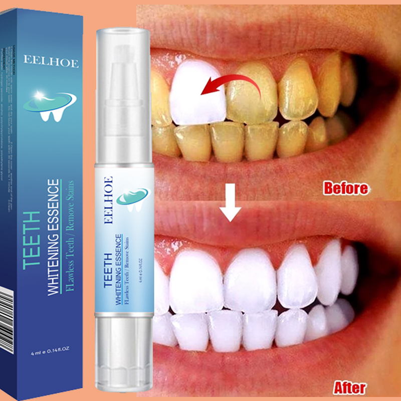 Teeth Whitening Pen Dental Ess - Teeth Whitening Serum ulasan dan harga