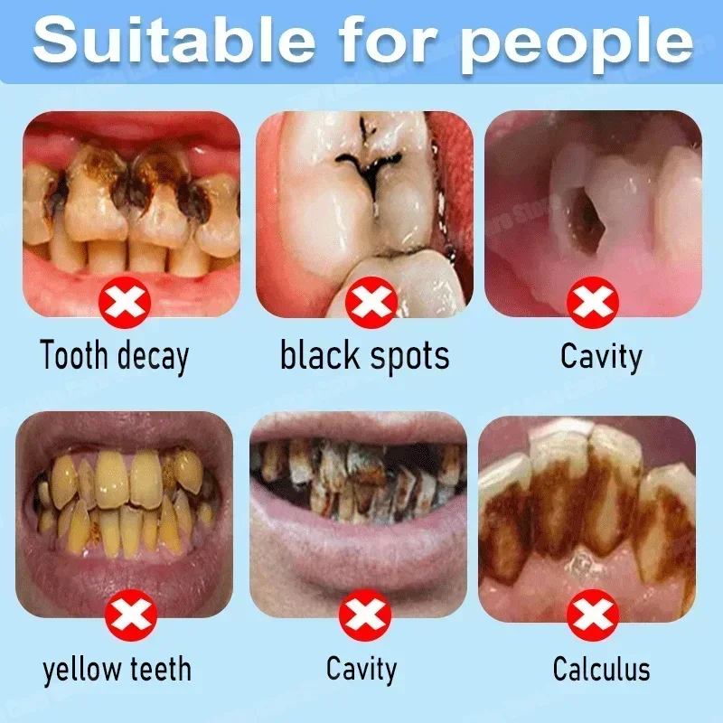 Anti Decay Toothpaste repairs  - Teeth Whitening That Works ulasan dan harga