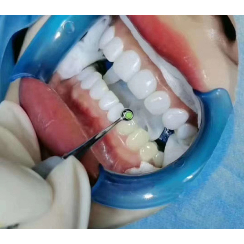 Dental Resin Filling Spatula D - Teeth Whitening Kit ulasan dan harga