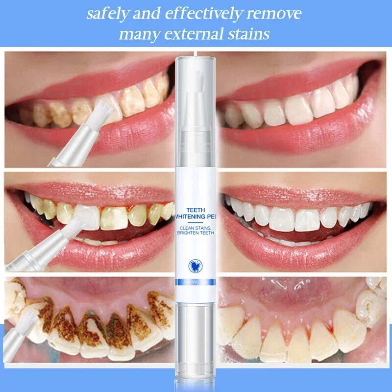 Teeth Whitening Pen Cleaning S - Teeth Whitening Serum ulasan dan harga