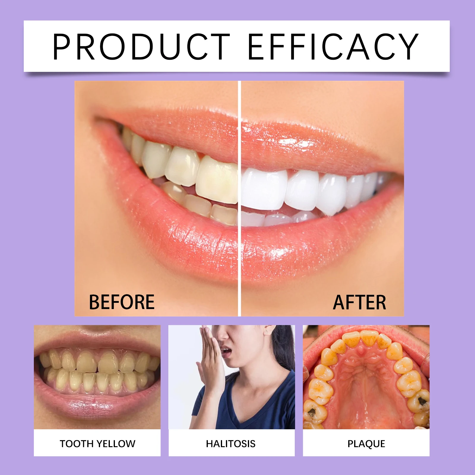 Teeth Whitening Pen Teeth Gel  - Teeth Whitening Serum ulasan dan harga